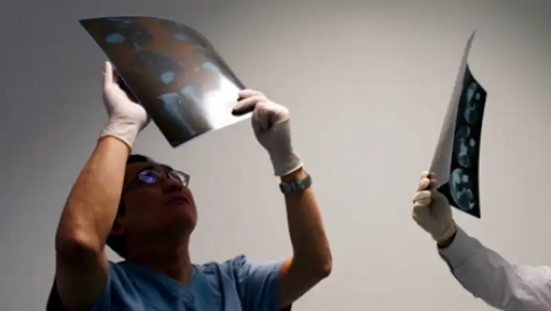 Из желудка китайской студентки извлекли 14-сантиметровую ложку 