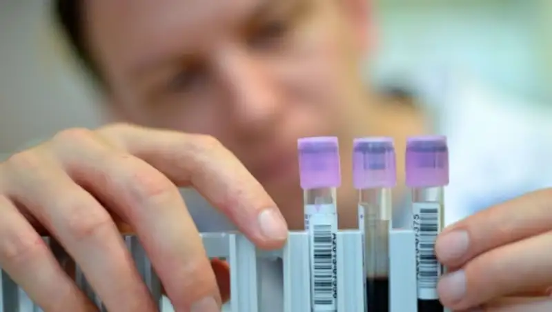 Минобороны Австралии: споры сибирской язвы, по ошибке присланные Пентагоном, безвредны