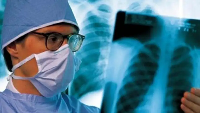 В Астане у школьного учителя выявили туберкулез