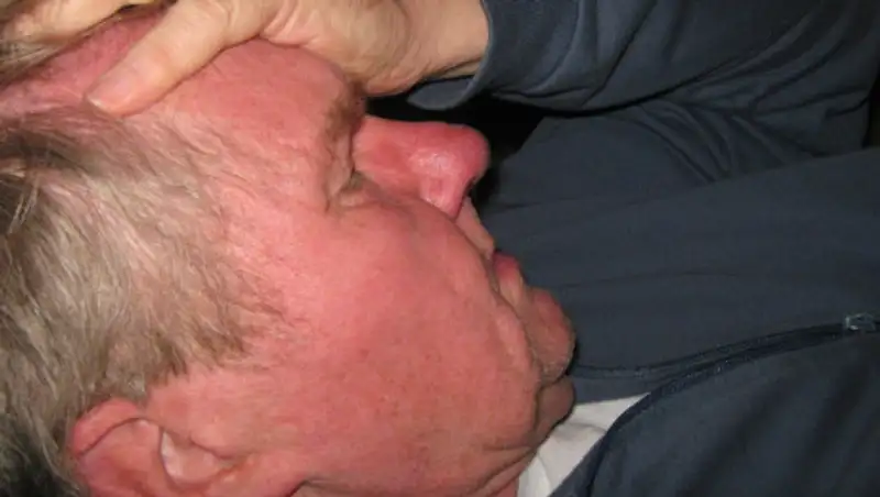 Как измерить внутриглазное давление