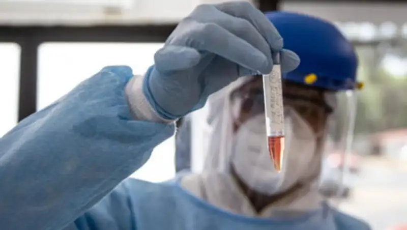 В России у границы с Казахстаном обнаружили возбудителя бубонной чумы