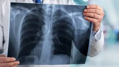 inform.kz, фото - Новости Zakon.kz от 04.11.2020 16:03