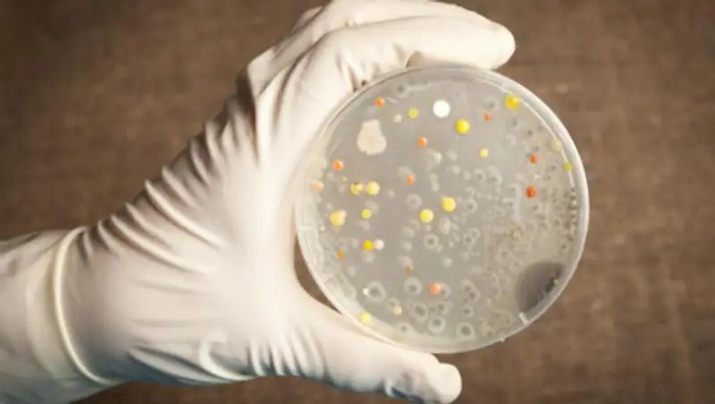 Сообщения о сибирской язве в Казахстане являются фейком - МСХ