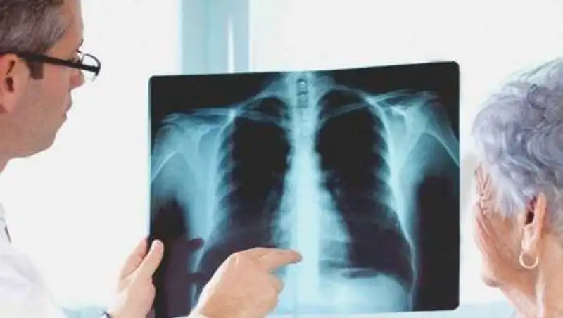 За сутки 24 казахстанца умерли от коронавируса и пневмонии