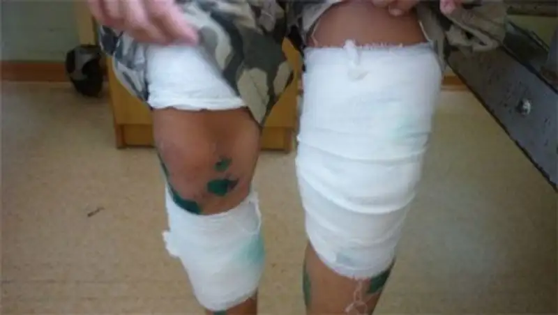 Американец выжил после 14 пулевых ранений