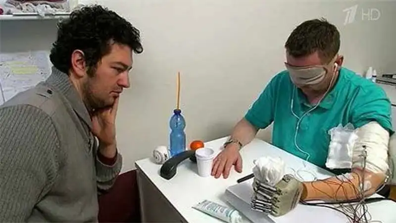 Ученые создали первый в мире протез руки с чувствительными пальцами