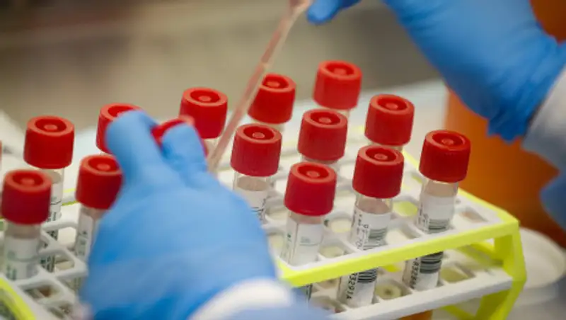 В Казахстане выявлены еще 46 случаев заражения КВИ