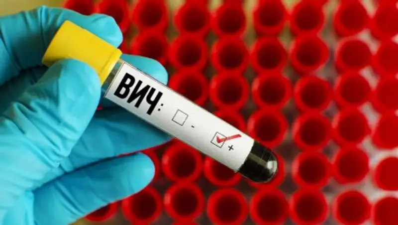 В 2016 году в Казахстане зарегистрировано 2725 случаев ВИЧ-инфекции