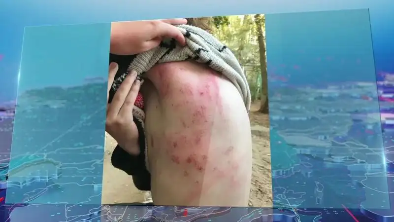 Избиение 14-летнего подростка в Павлодаре: родители требуют наказать свидетелей