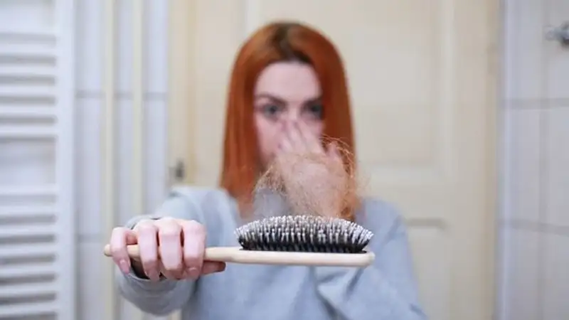 Связь между ожирением и облысением объяснила врач