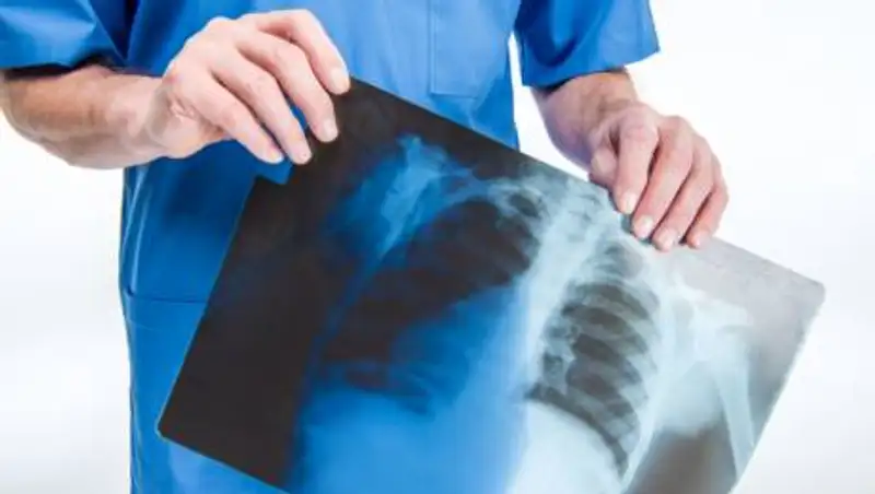 Самое низкое число случаев коронавирусной пневмонии выявлено в Казахстане