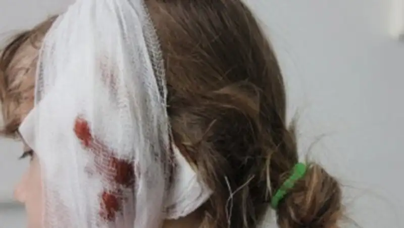 В ЗКО хозяйку откусившего ухо ребенку пса оштрафовали на миллион