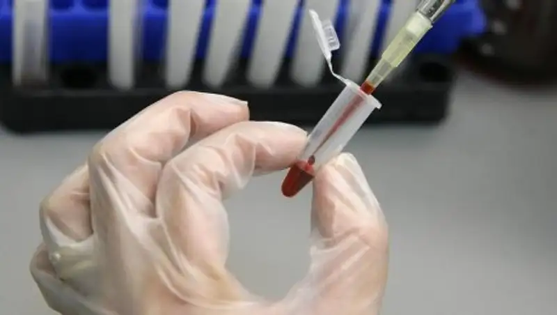 Создана специальная комиссия для выяснения причин заболевания гепатитом в с. Шолпан ВКО