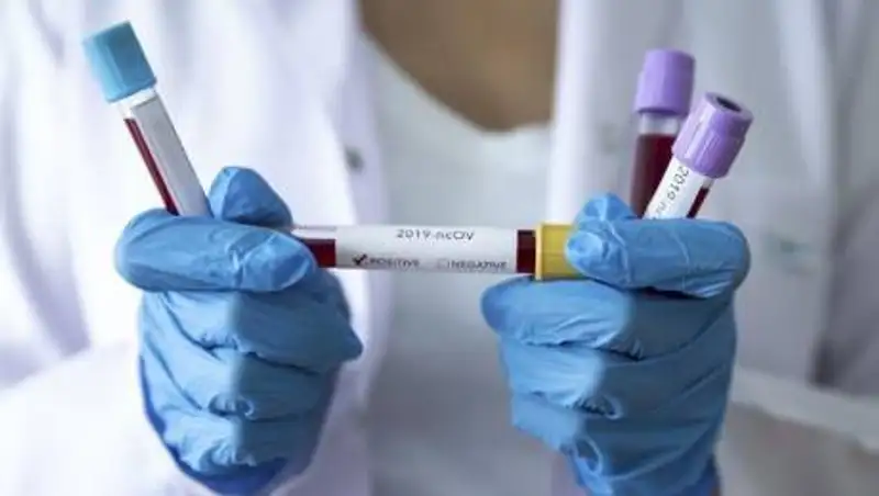 Найдена "ахиллесова пята" коронавируса