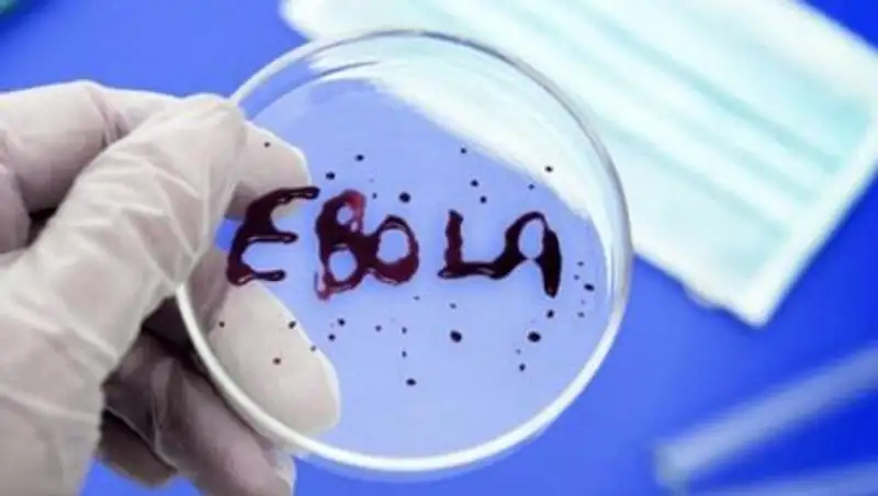 Казахстан через спецфонд ООН оказал помощь странам Африки по борьбе с вирусом Эбола