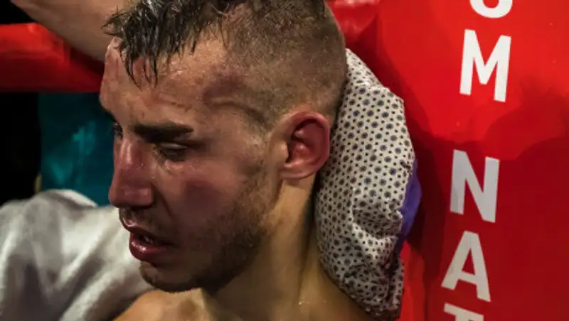 Боксер Максим Дадашев умер после боя