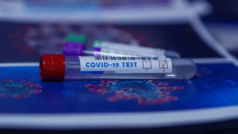 За сутки в Казахстане выявили 72 зараженных коронавирусом