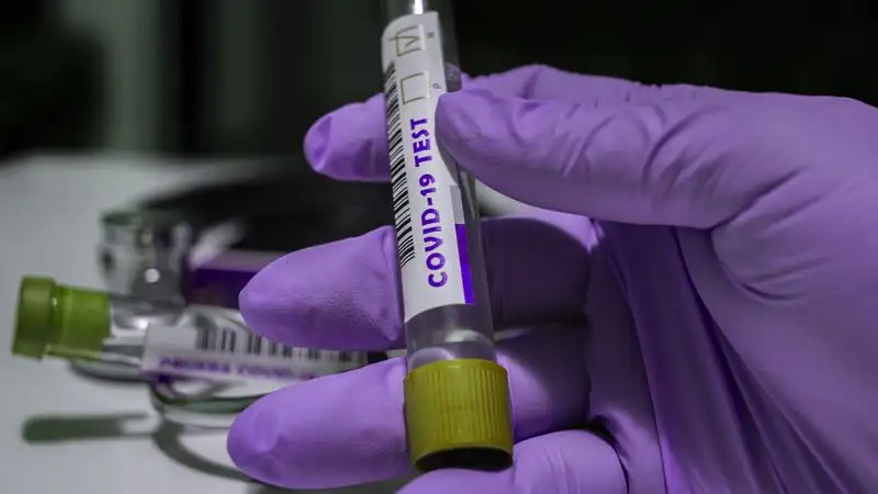 В Казахстане за сутки зарегистрировано 87 новых случаев заражения коронавирусом