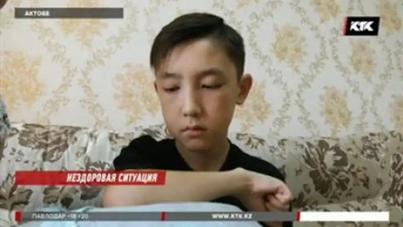 После лечения перелома у актюбинского пятиклассника отмерли костные ткани