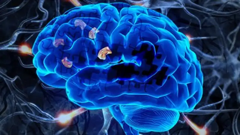 Ученые случайно открыли лекарство от болезни Альцгеймера