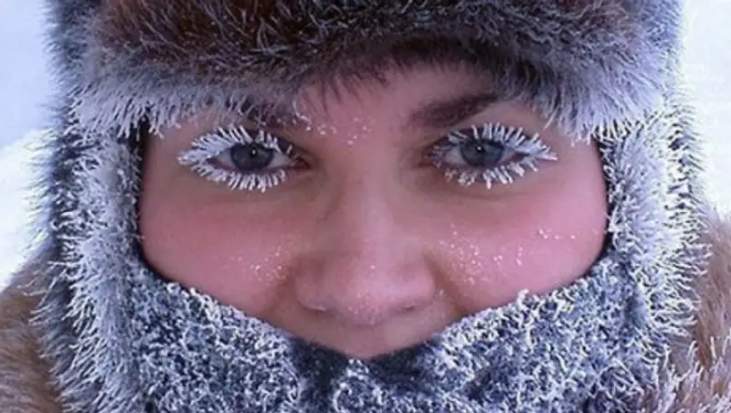 Что делать при обморожении