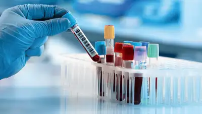 Vitamin Köln, фото - Новости Zakon.kz от 24.03.2020 18:04