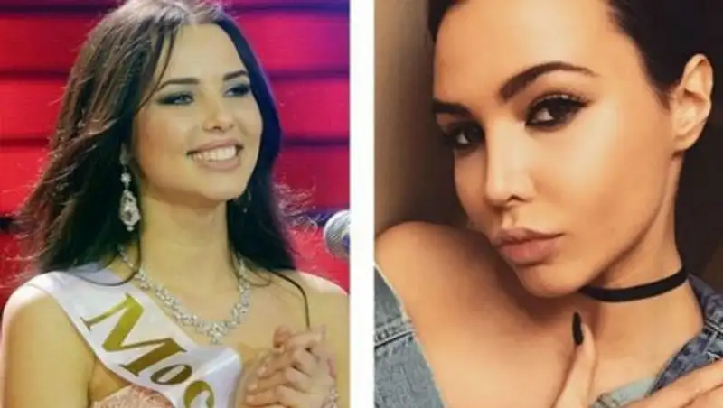 Известные российские красавицы до и после пластики