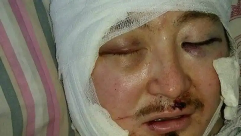 Покушение на кыргызского теолога совершили сторонники ИГ, которые скрылись в Турции