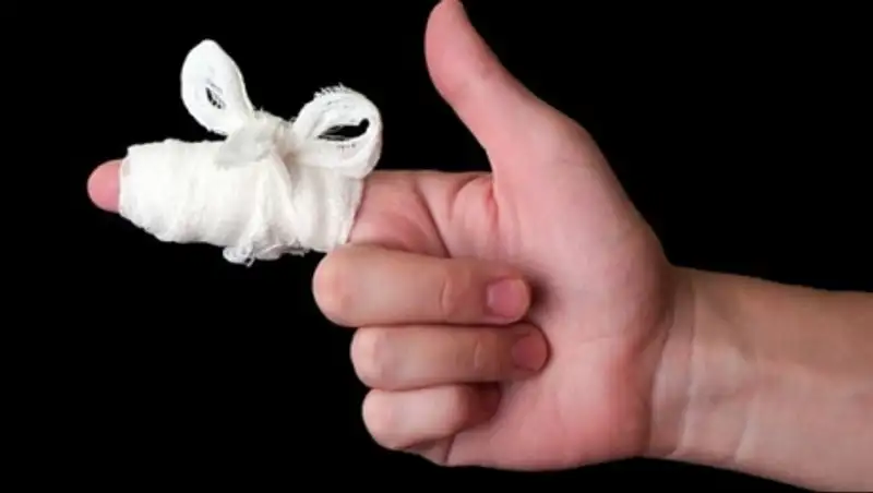 Студент из Калмыкии откусил пол пальца московскому полицейскому