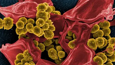 Pixabay, фото - Новости Zakon.kz от 24.01.2020 20:35