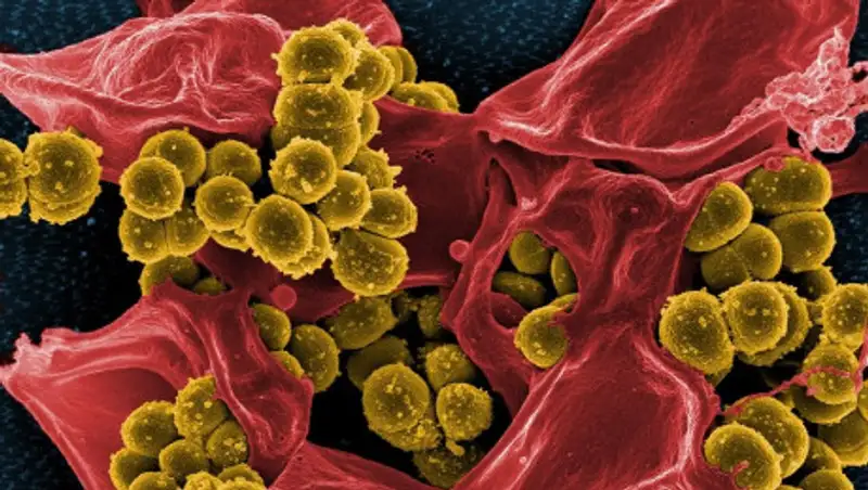 Вспышку инфекции зафиксировали в Уганде