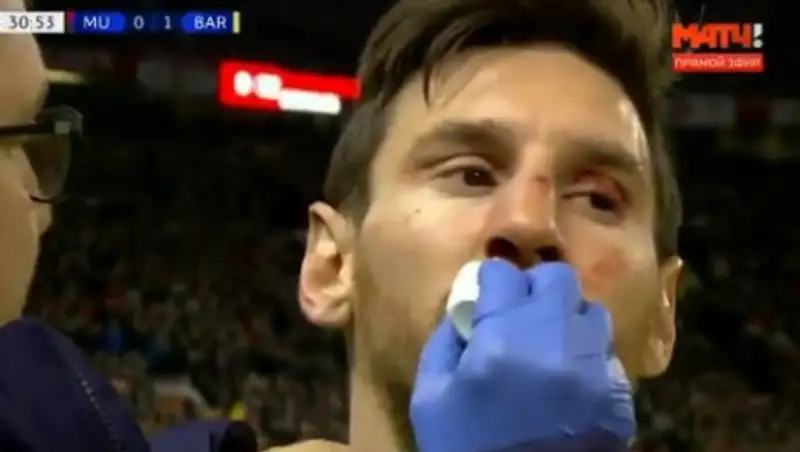 Месси разбили лицо в матче Лиги чемпионов