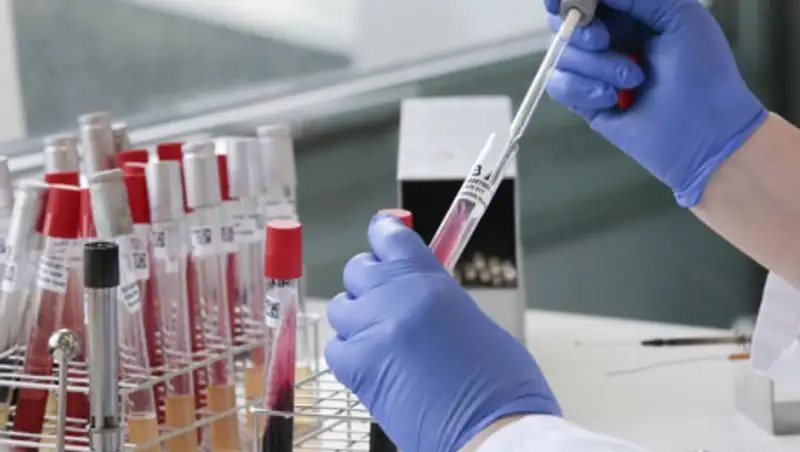 В Швейцарии число заразившихся коронавирусом достигло 30 893