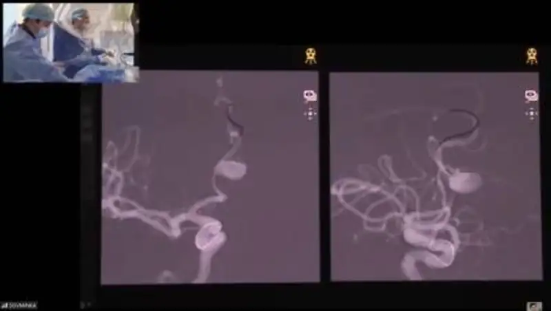 В Совминке прошел международный дискуссионный нейрокурс