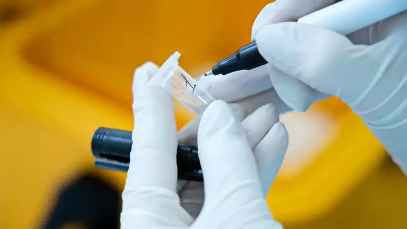 Более 100 казахстанцев заболели коронавирусом за сутки