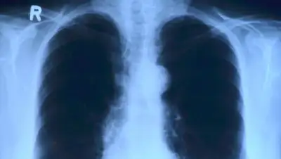 КТ, фото - Новости Zakon.kz от 19.07.2022 18:18