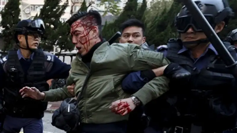 Число пострадавших при беспорядках в Гонконге достигло 90