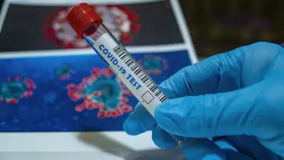 коронавирус, ПЦР-тест , фото - Новости Zakon.kz от 03.05.2022 10:03