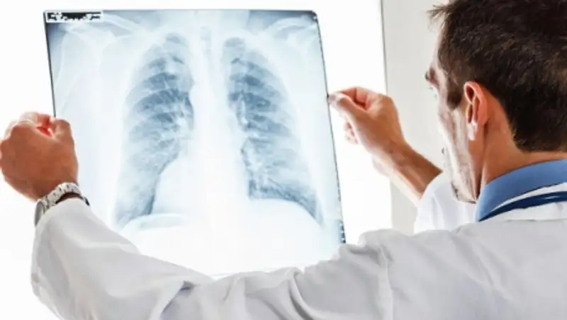 В Литве учительница заразила туберкулезом 77 школьников