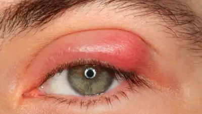 из открытых источников, фото - Новости Zakon.kz от 04.02.2019 13:10