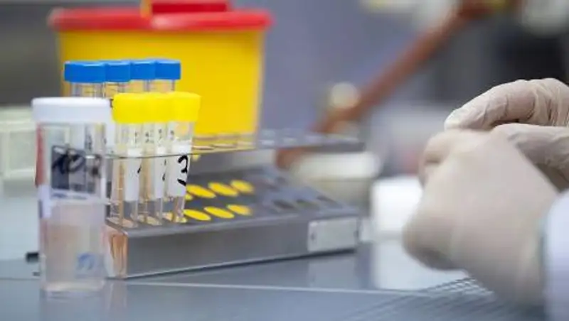 О текущей эпидемиологической ситуации в Алматы