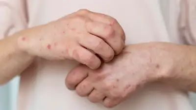 Казахстан Астана антиваксеры переубеждение служители мечетей и церквей