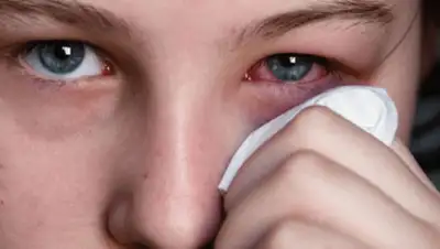 yellmed.ru, фото - Новости Zakon.kz от 08.04.2019 14:00