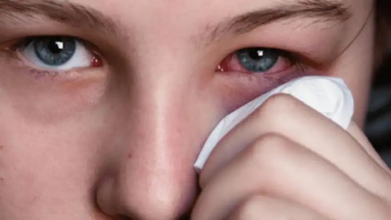 Симптомы, диагностика и лечение бактериального кератита