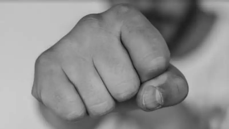 Астанчанин выбил женщине два передних зуба за отказ потанцевать