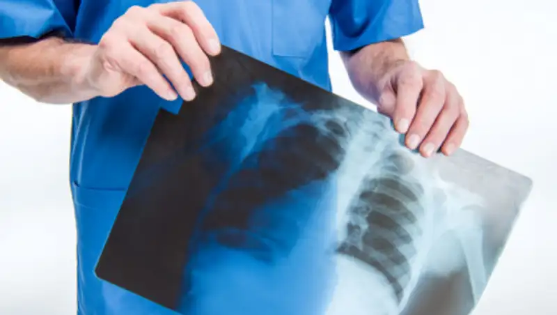 В Казахстане за сутки от пневмонии скончались 4 человека