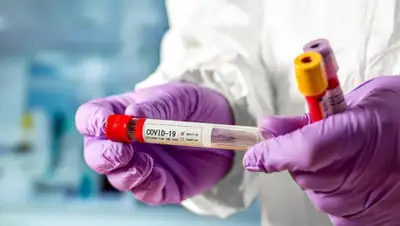 coronavirus2020, фото - Новости Zakon.kz от 29.06.2020 08:01