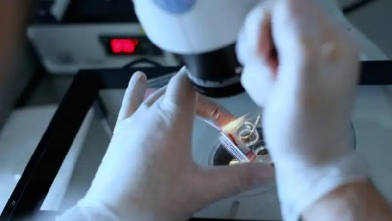 Ученые нашли механизм самоуничтожения раковых опухолей