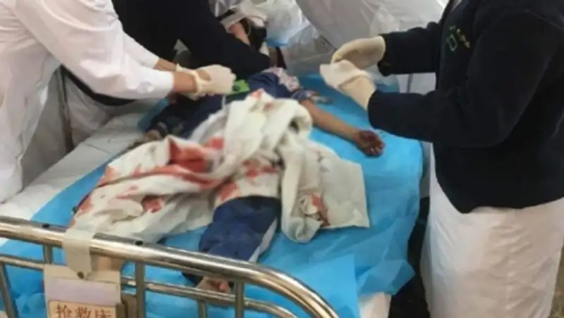 В Китае мужчина с ножом изрезал учеников начальной школы