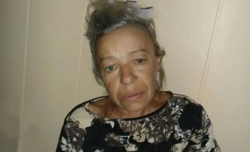 В больницу Талдыкоргана доставили жительницу ВКО, страдающую провалами в памяти